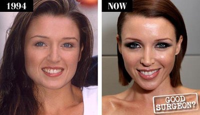Dannii Minogue